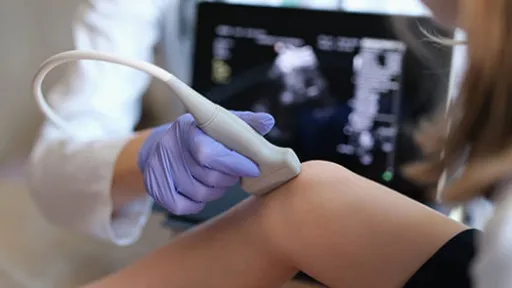 Diagnostic medical sonographer scans patient's knee.
