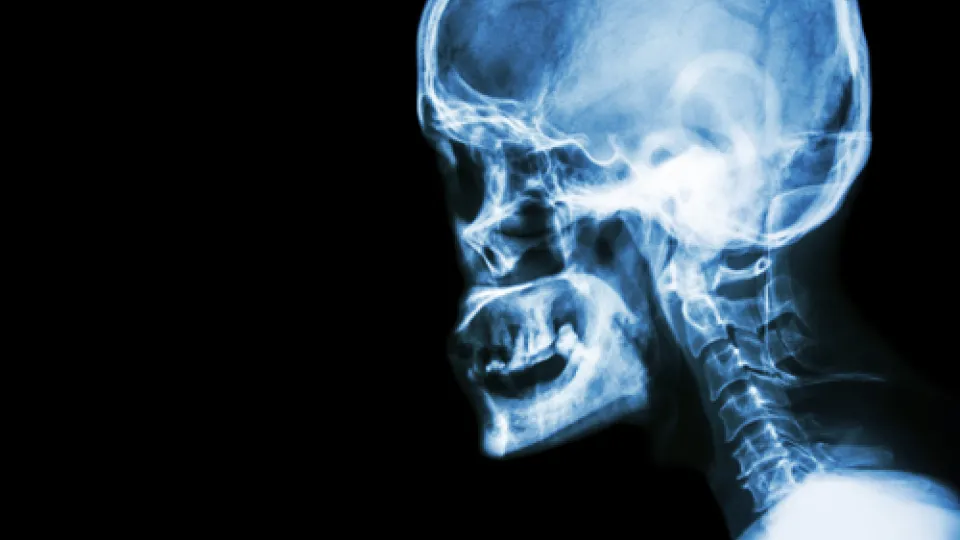 polysomnographic-technology-2 polysomnographic technology